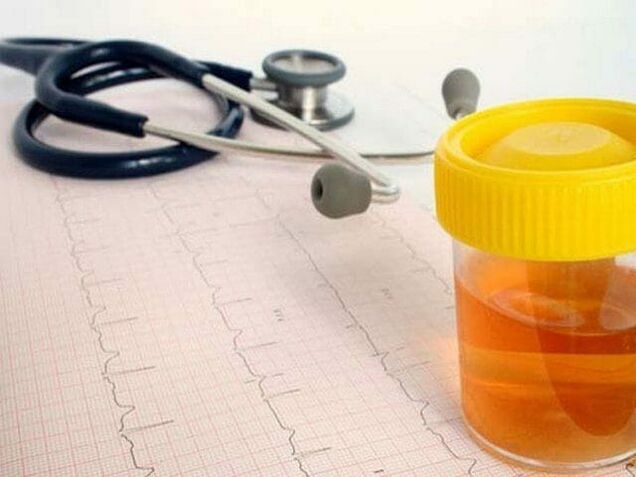 analiza urinei pentru a diagnostica cistita